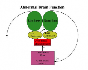 abnormalbrainfunction-300x237