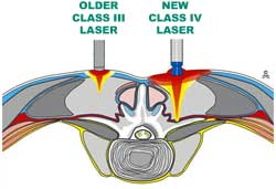 lasercartoon